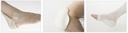 SMDERMHEEL_image_2