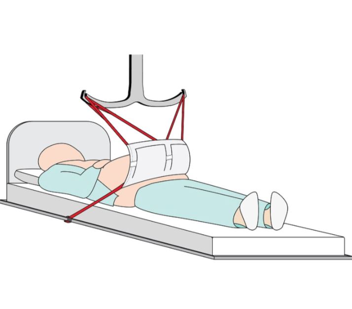 [6950F] Pannus Apron Sling (100cm, With Flap)